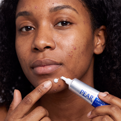 Pear™ - Acne Cream